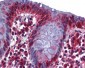 RBM47 antibody - middle region